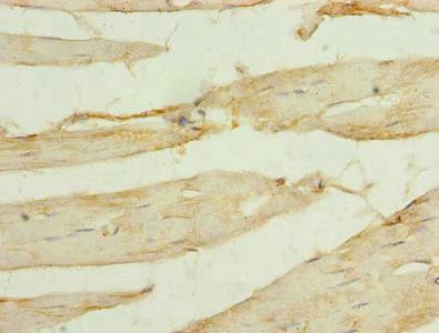 SORBS3 Antibody
