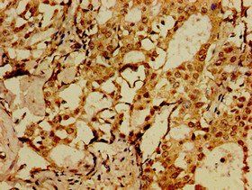 SORCS1 Antibody
