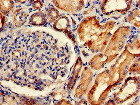 SORCS2 Antibody