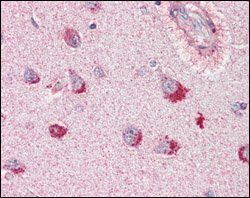 SORL1 Antibody