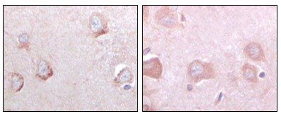 SORL1 Antibody