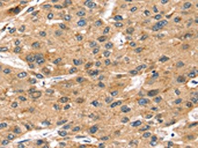 SORT1 Antibody
