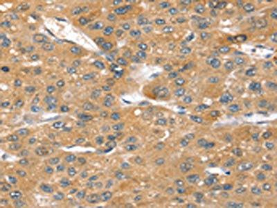 SORT1 Antibody