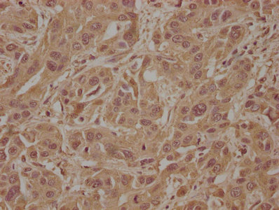 SOS2 Antibody