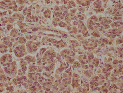 SOS2 Antibody