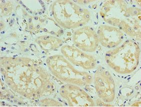 SOST Antibody