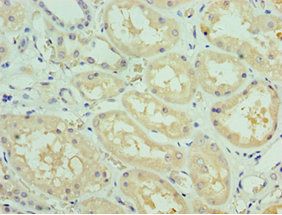 SOST antibody