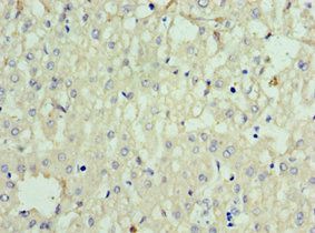 SOST Antibody