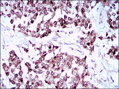 SOX10 Antibody