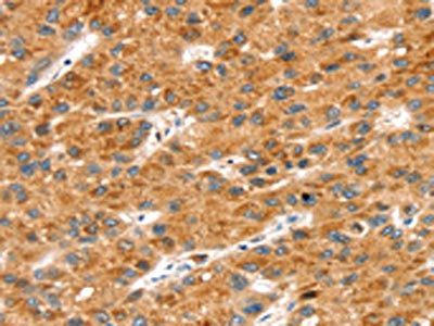 SOX11 antibody