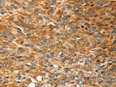 SOX11 Antibody