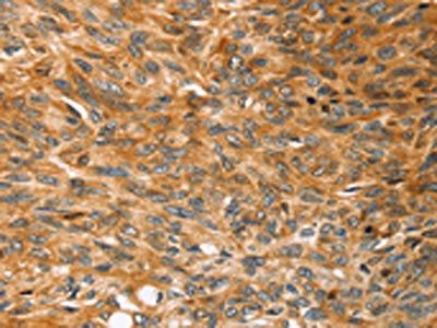 SOX11 antibody