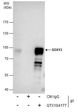 SOX13 antibody