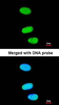 SOX13 antibody