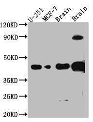 SOX2 Recombinant Monoclonal Antibody
