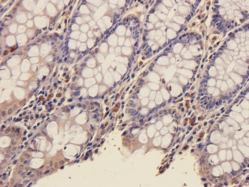 SOX2 antibody