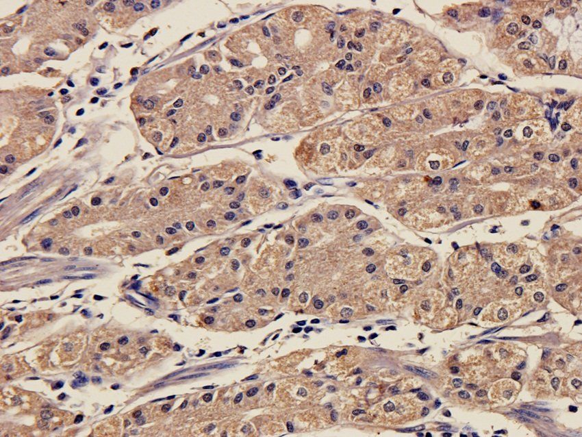 SOX2 antibody