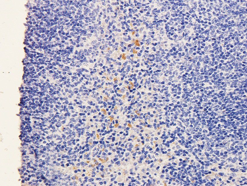 SOX2 antibody