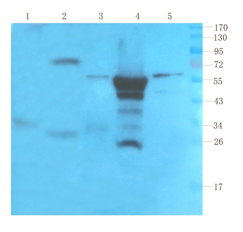 SOX2 antibody