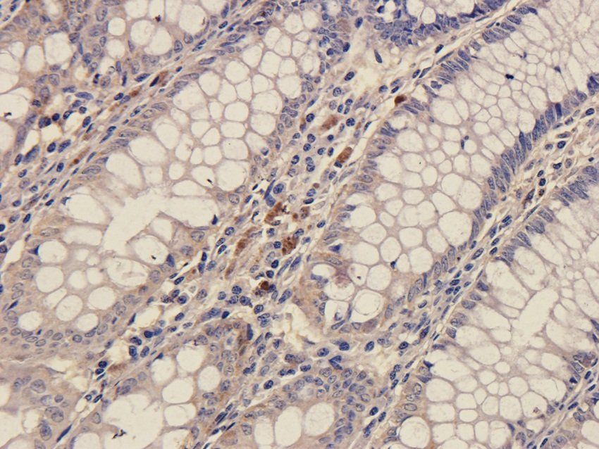 SOX2 antibody