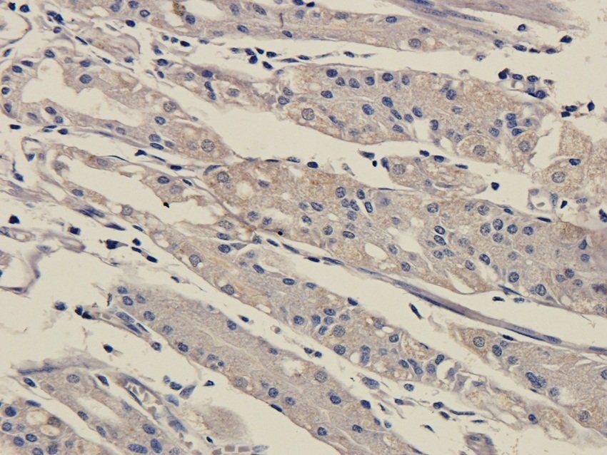 SOX2 antibody