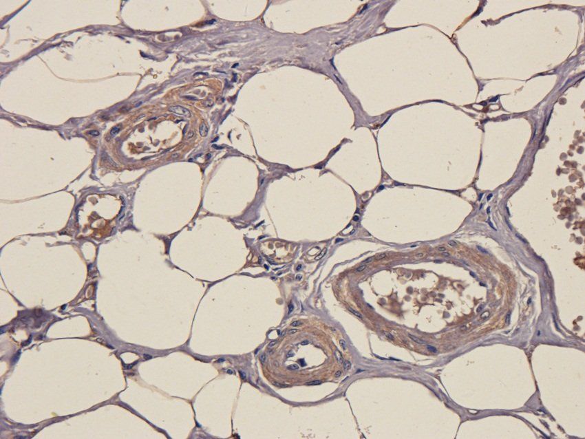 SOX2 antibody