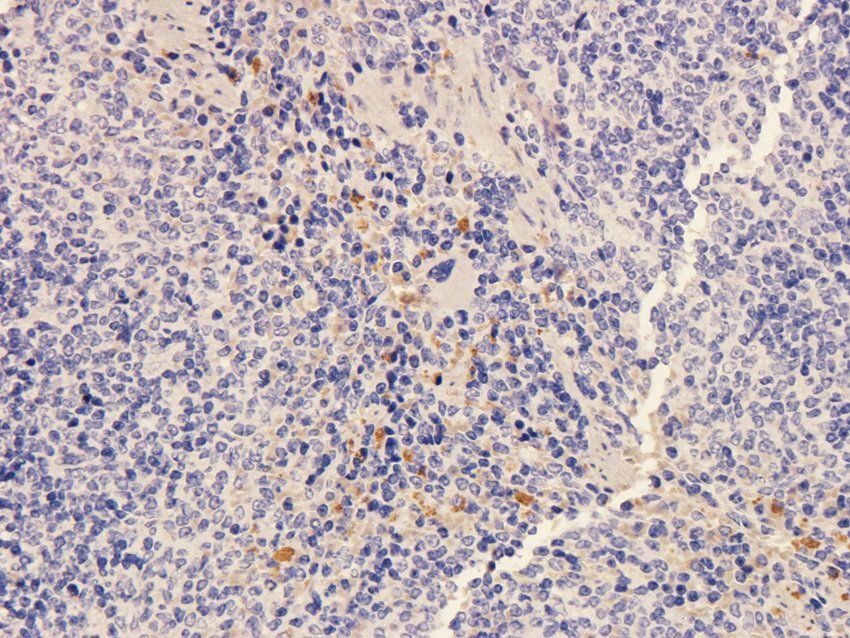 SOX2 antibody