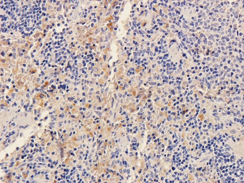 SOX2 antibody