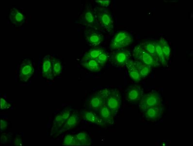 SOX30 Antibody