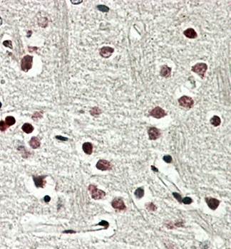 SOX3 antibody