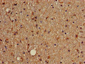 SOX4 Antibody
