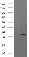 SOX5 Antibody