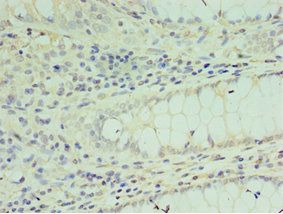 SOX6 Antibody