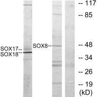 SOX8 antibody