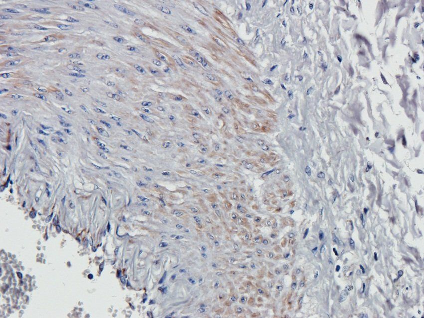 SOX9 antibody