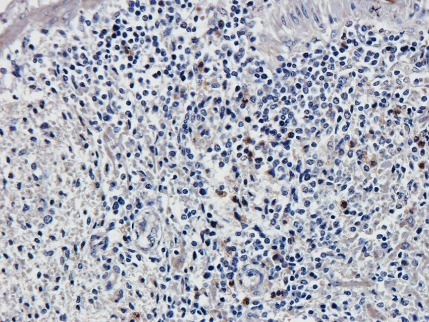 SOX9 antibody