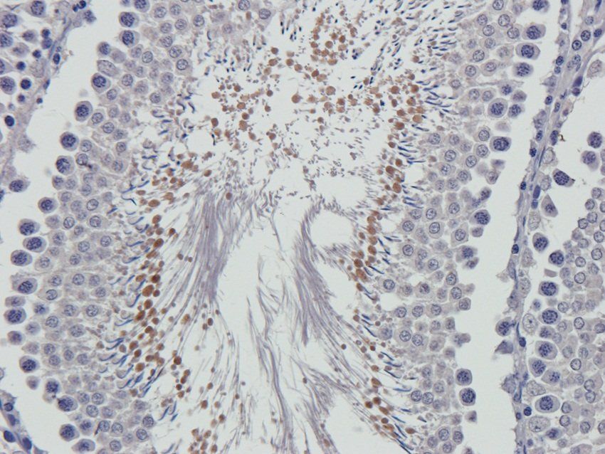 SOX9 antibody