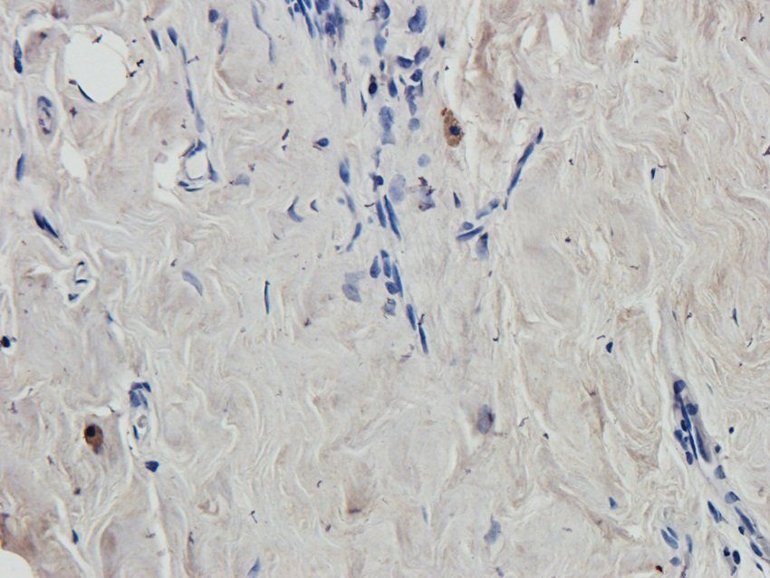 SOX9 antibody