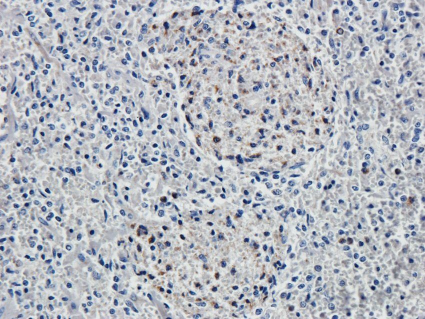 SOX9 antibody