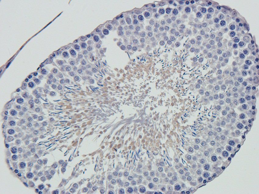 SOX9 antibody