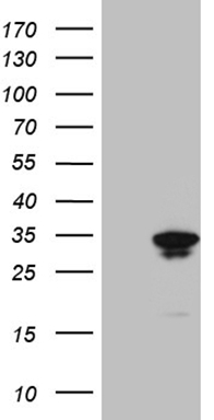 SP110 Antibody