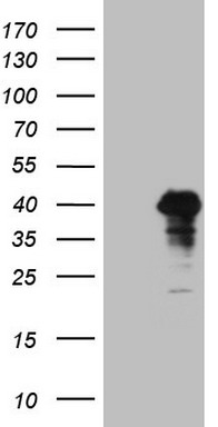 SP110 Antibody