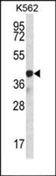 SP6 antibody