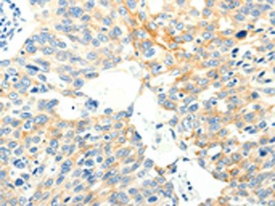SPAG5 Antibody