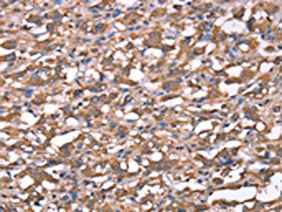SPAST Antibody