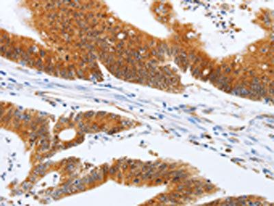 SPATA13 Antibody