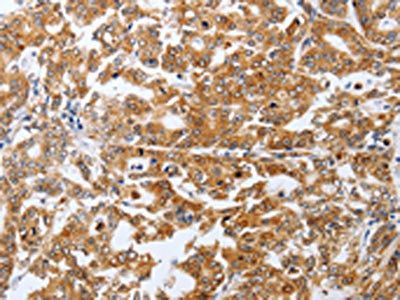 SPATA13 Antibody