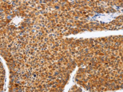SPATA13 Antibody