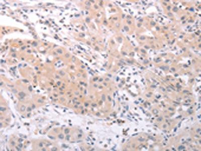 SPATA16 Antibody