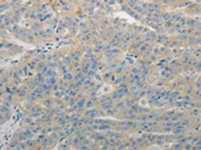 SPATA17 Antibody